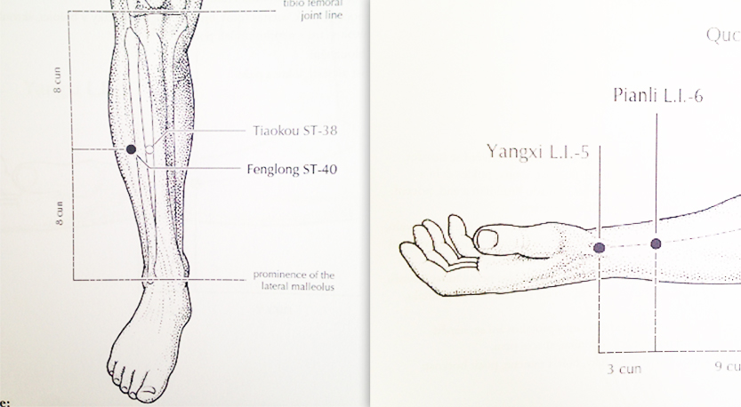 Akupunkturní body ST40, LI5 a LI6
