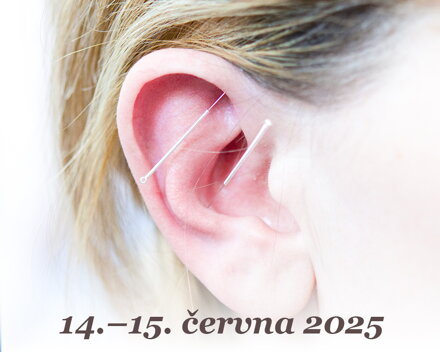 Aurikuloterapie 2: ušní akupunktura pro pokročilé (14.–15. 6. 2025)